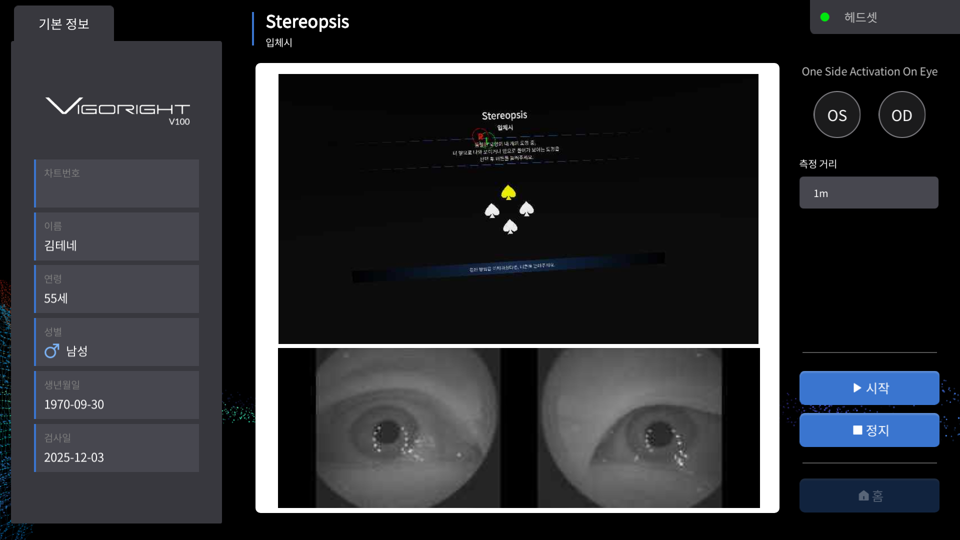 입체시(Stereopsis)